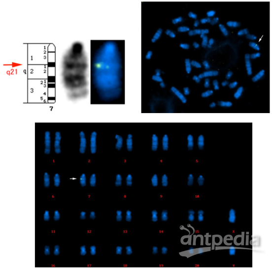  检测大鼠转入基因的染色体定位。如图所示，外源基因位于大鼠染7号染色体的q21区域。