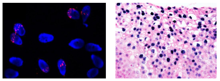 FISH 和ISH方法检测细胞和组织中HPV病毒颗粒 