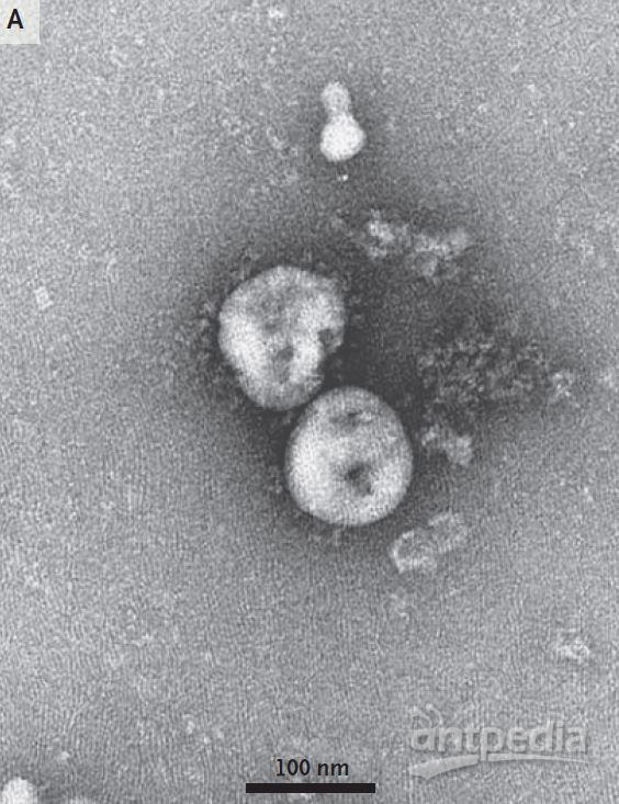 新冠病毒电镜图片图片